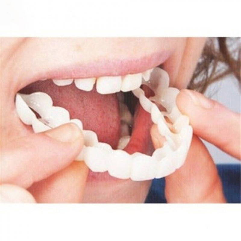 Teeth Whitening Veneers - 완벽하게 맞는 틀니 커버 미백 스냅온