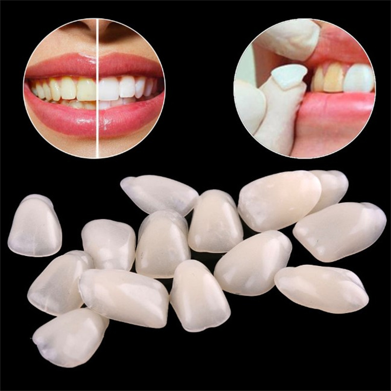 Teeth Whitening Veneers - 임시 치아 베니어 - 치아 미백