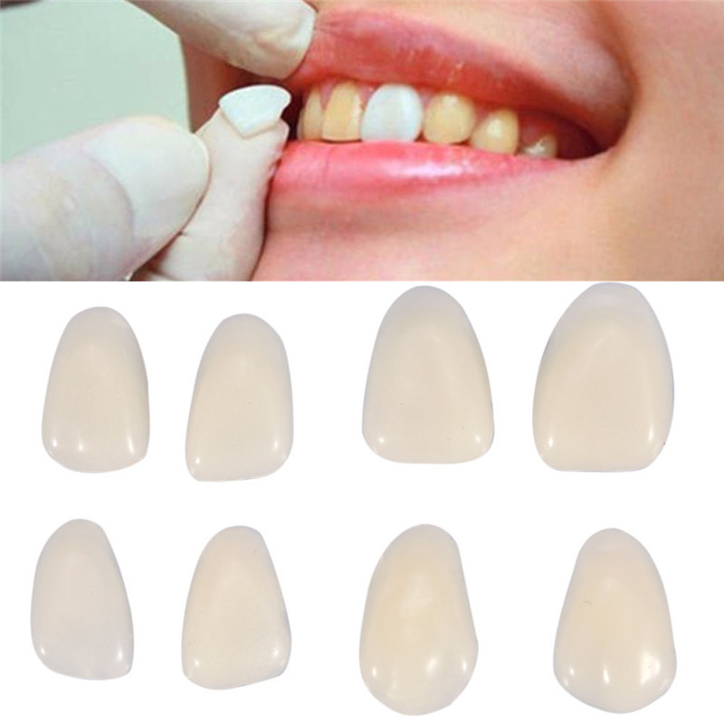Teeth Whitening Veneers - 치과 틀니 임시 크라운 치아 베니어