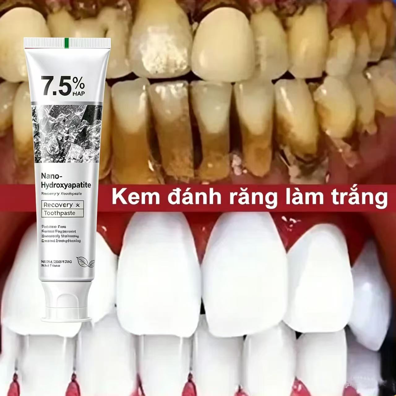 Teeth Whitening Cream - 7.5% 하이드록시아파타이트 프로바이오틱 미백 치약 에나멜