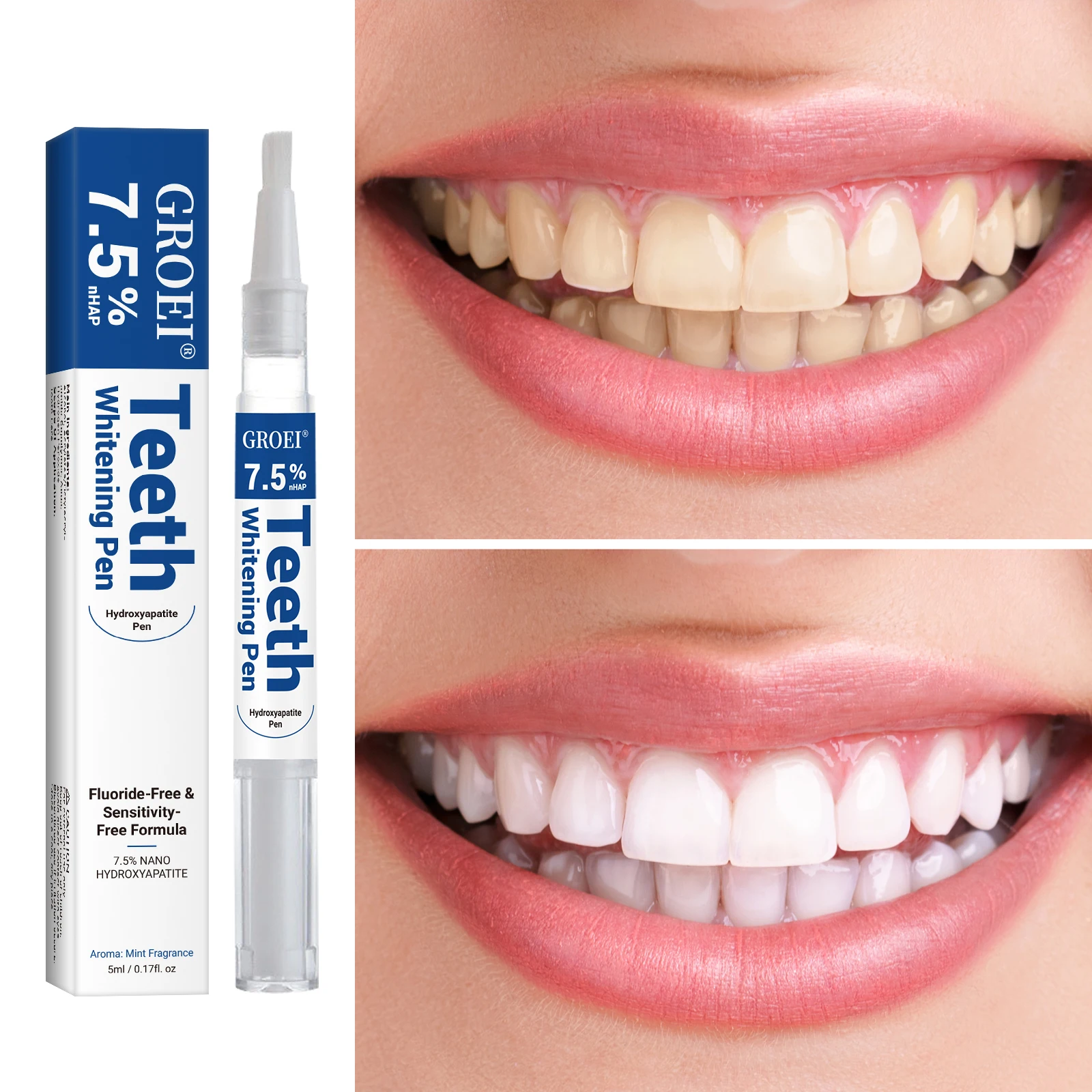 하이드록시아파타이트 치아 미백 펜 눈부신 화이트 얼룩  - Teeth Whitening App 리뷰 및 가격