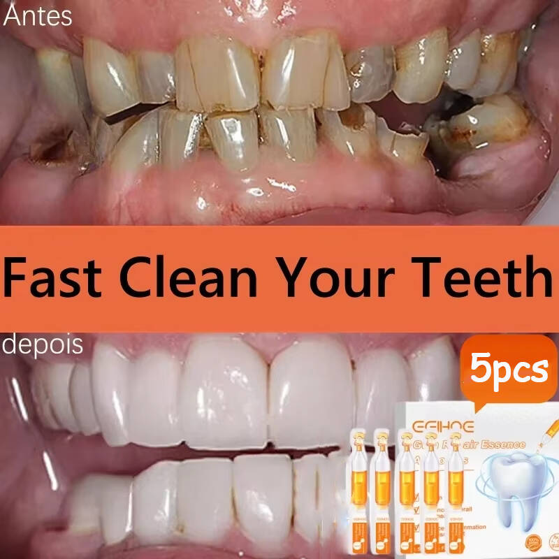치약 세럼으로 빠르게 치아 주위 조직 회복, 치아 미백 - Teeth Whitening With Baking Soda 리뷰 및 가격