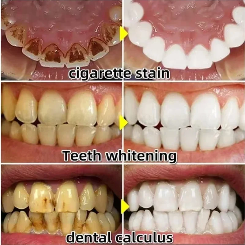 치약 세럼으로 빠르게 치아 주위 조직 회복, 치아 미백 - Teeth Whitening With Baking Soda 리뷰 및 가격