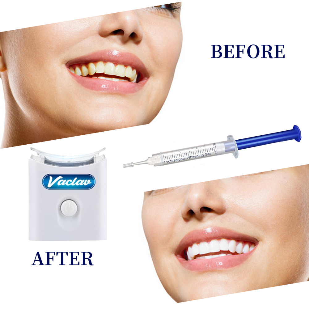 민트 치아 미백 젤 주사기 가정용 치아 미백 키트 LE - Teeth Whitening With Baking Soda 리뷰 및 가격