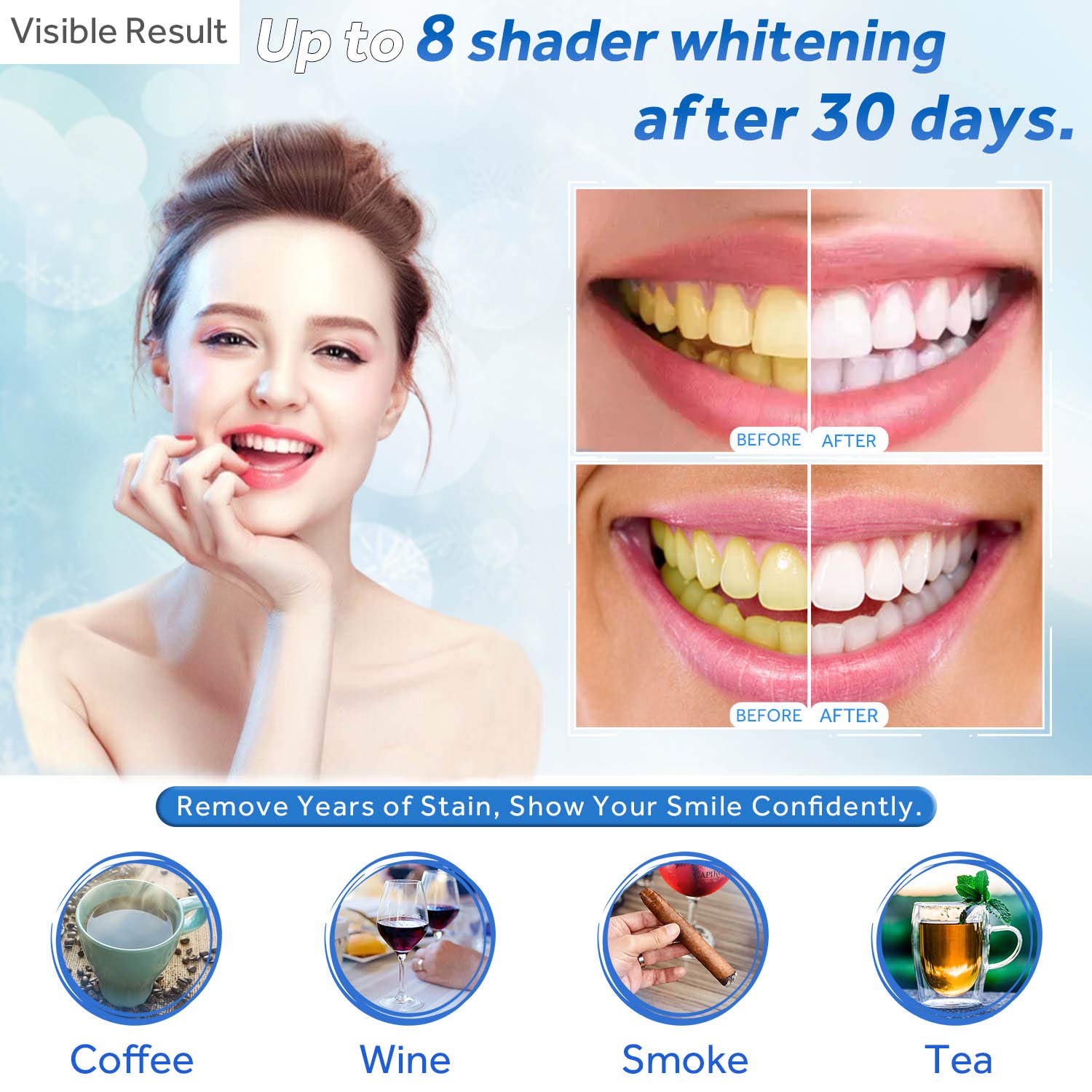 치아 미백 젤 리필 주사기 치아 미백 젤 인비스알라인  - Teeth Whitening App 리뷰 및 가격