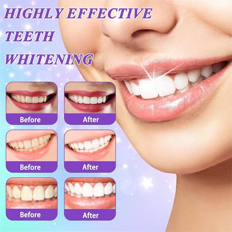 9D 퍼플 치아 미백 치약 무스, 누런 치아 및 플라그 - Teeth Whitening Cream 리뷰 및 가격