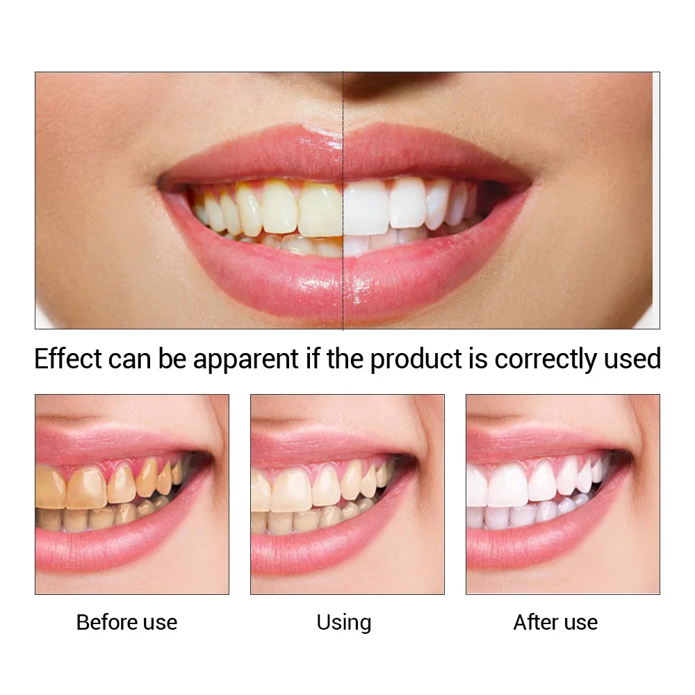 FTEENPLY 치아 미백 에센스 파우더 구강 위생 청 - Teeth Whitening Cream 리뷰 및 가격