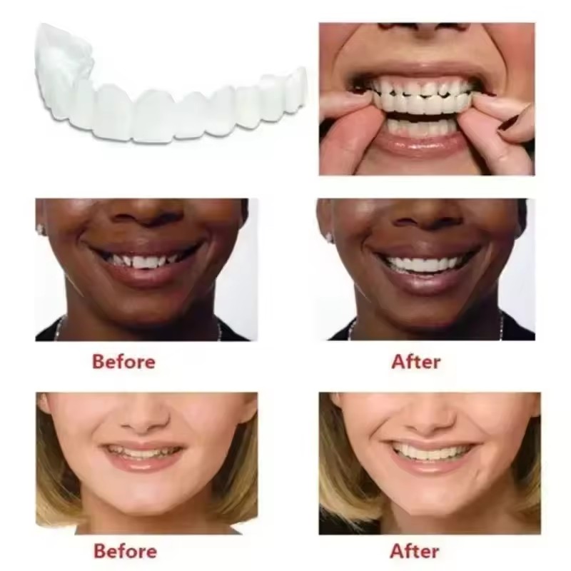치아 베니어 화이트닝 틀니 교정기 임시 가짜 치아 커버 - Teeth Whitening Veneers 리뷰 및 가격