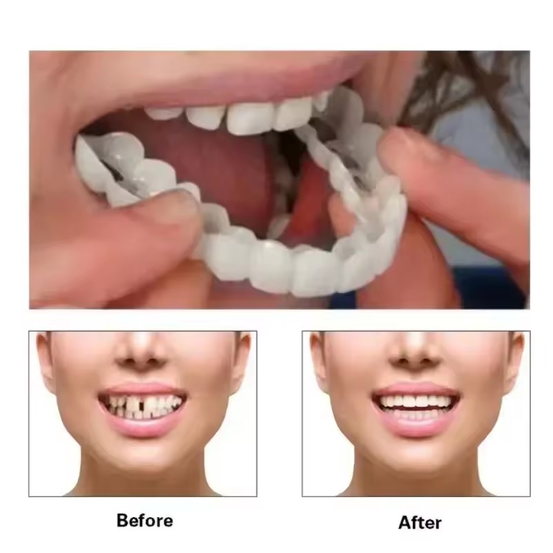 치아 베니어 화이트닝 틀니 교정기 임시 가짜 치아 커버 - Teeth Whitening Veneers 리뷰 및 가격