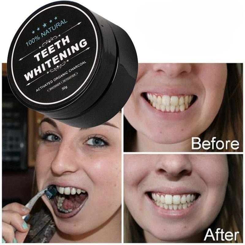 활성탄 치아 미백 파우더 1박스, 숯 치아 클리닝 파우 - Teeth Whitening China 리뷰 및 가격
