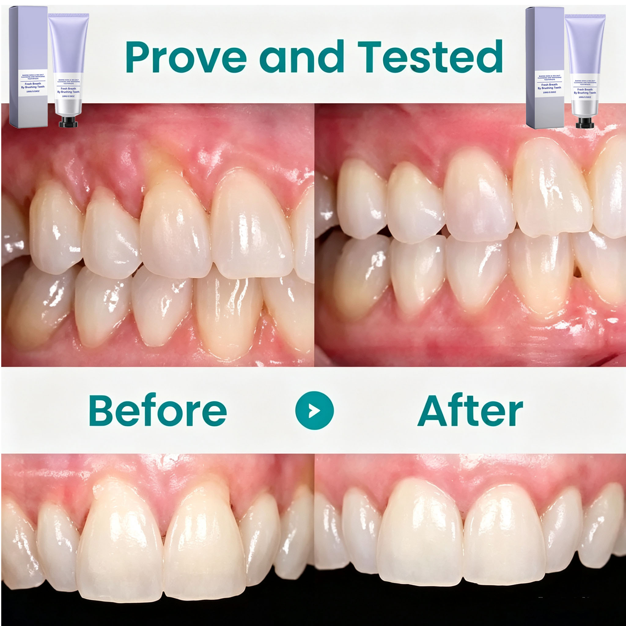 베이킹소다 & 해염 치약, 딥 클렌징, 치아 미백, 상 - Teeth Whitening With Baking Soda 리뷰 및 가격