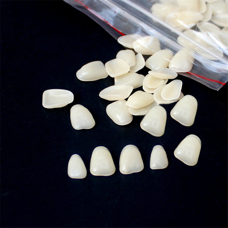 치과 틀니 임시 크라운 치아 베니어 치아 상부 전방 미 - Teeth Whitening Veneers 리뷰 및 가격