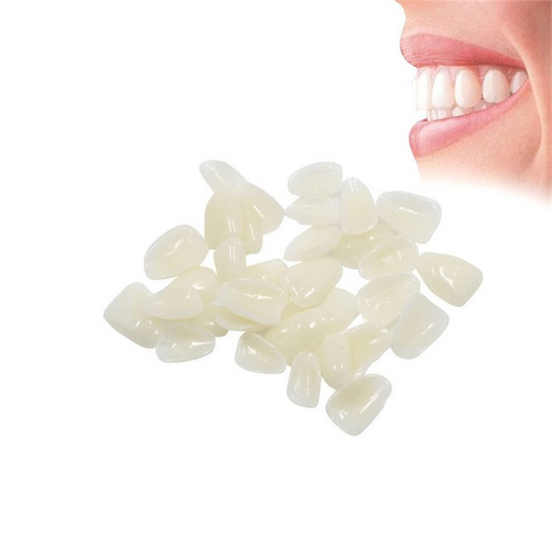 치과 틀니 임시 크라운 치아 베니어 치아 상부 전방 미 - Teeth Whitening Veneers 리뷰 및 가격