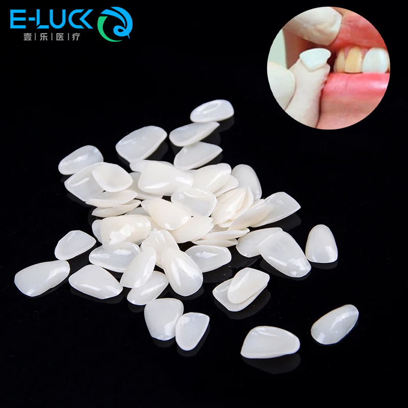 50pcs 치과 치아 베니어 임시 크라운 치과 치아를위 - Teeth Whitening Veneers 리뷰 및 가격