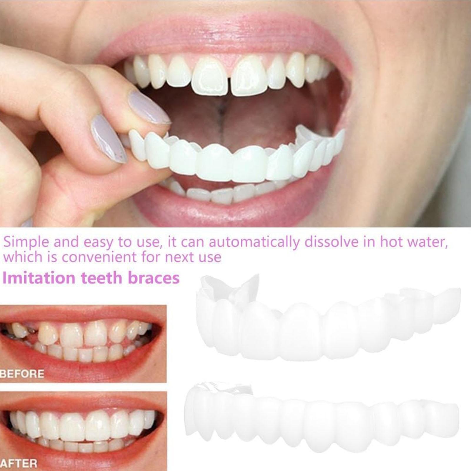 남녀 공용 임시 치아 베니어 상하악용 임시 미소 개선기 - Teeth Whitening Veneers 리뷰 및 가격