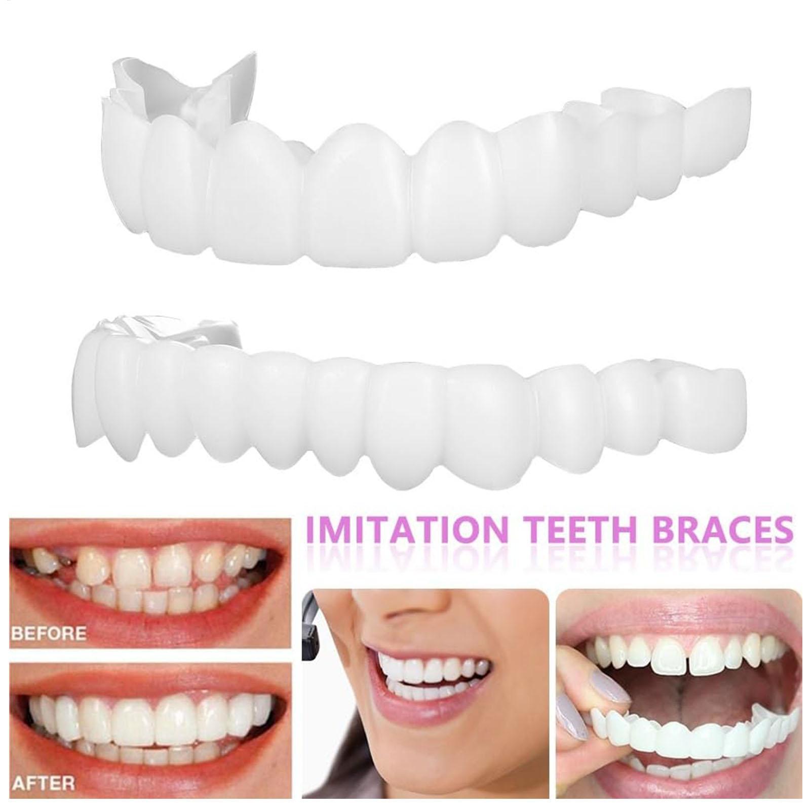 남녀 공용 임시 치아 베니어 상하악용 임시 미소 개선기 - Teeth Whitening Veneers 리뷰 및 가격
