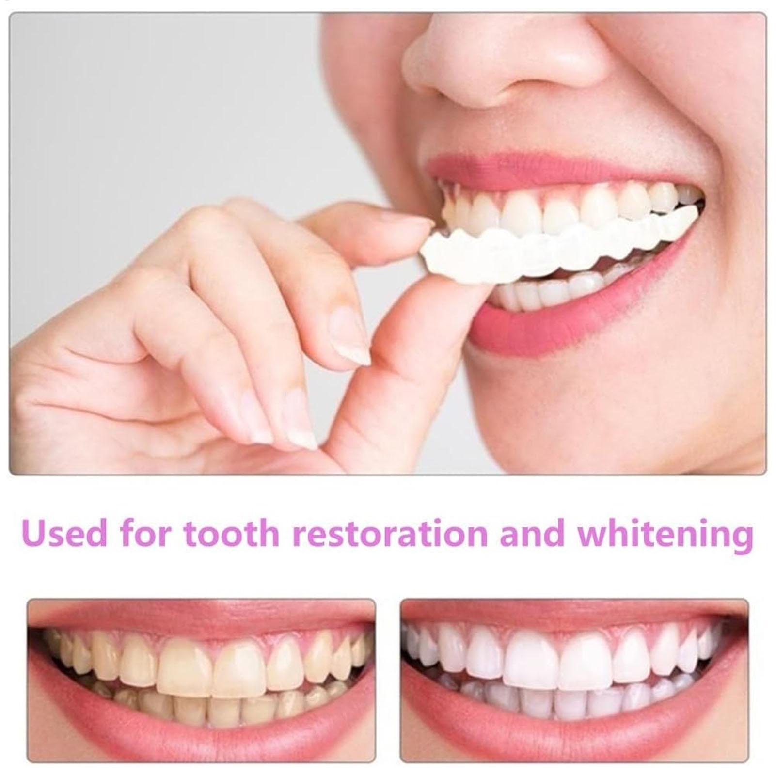 남녀 공용 임시 치아 베니어 상하악용 임시 미소 개선기 - Teeth Whitening Veneers 리뷰 및 가격