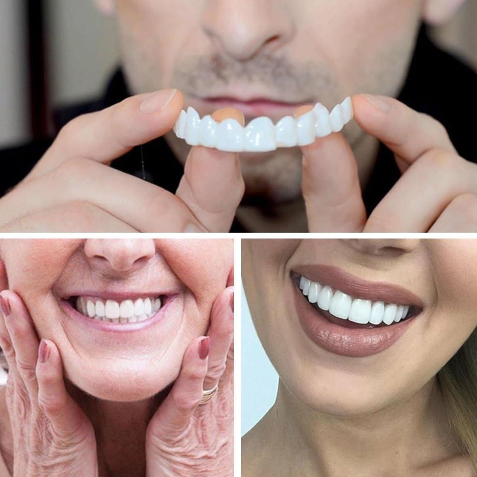 남녀 공용 임시 치아 베니어 상하악용 임시 미소 개선기 - Teeth Whitening Veneers 리뷰 및 가격