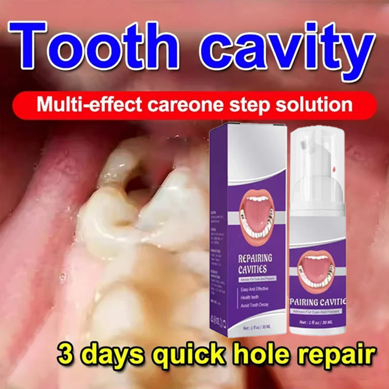 치아 세정 치약은 치아 얼룩 제거, 치아 미백, 치아  - Teeth Whitening Cream 리뷰 및 가격