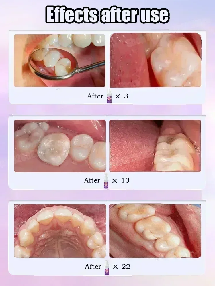 치아 세정 치약은 치아 얼룩 제거, 치아 미백, 치아  - Teeth Whitening Cream 리뷰 및 가격