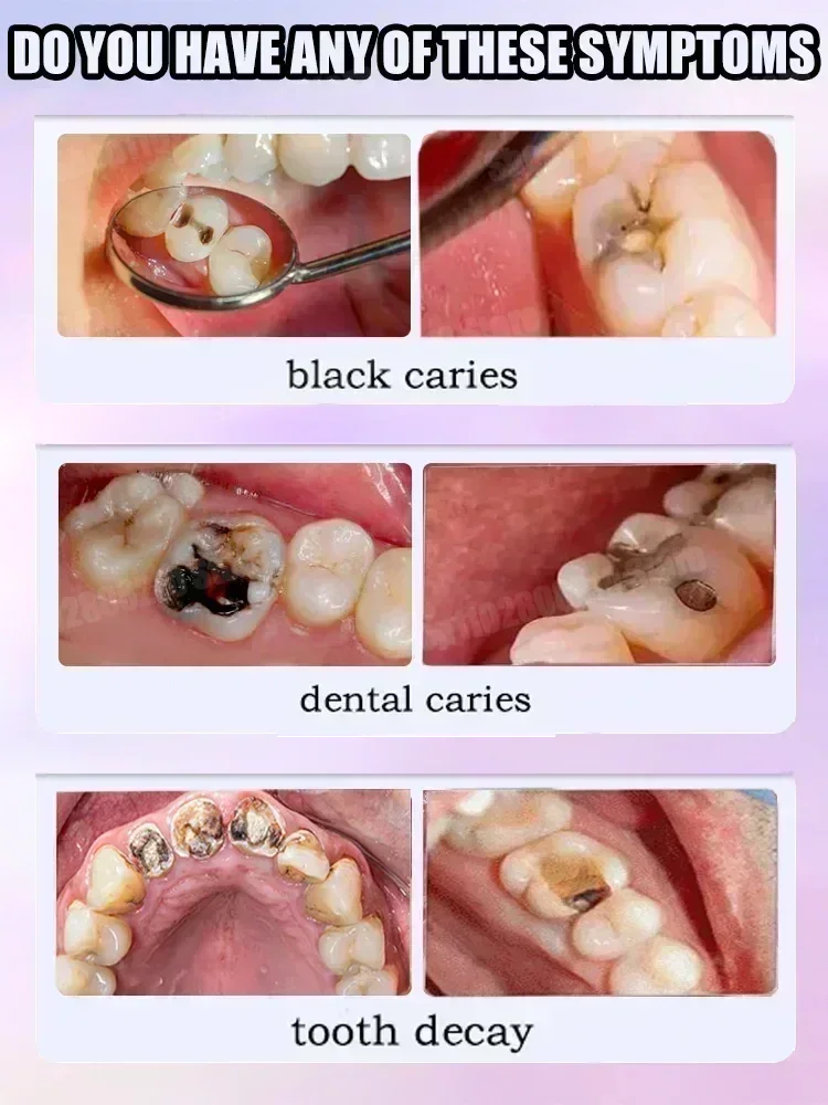 치아 세정 치약은 치아 얼룩 제거, 치아 미백, 치아  - Teeth Whitening Cream 리뷰 및 가격